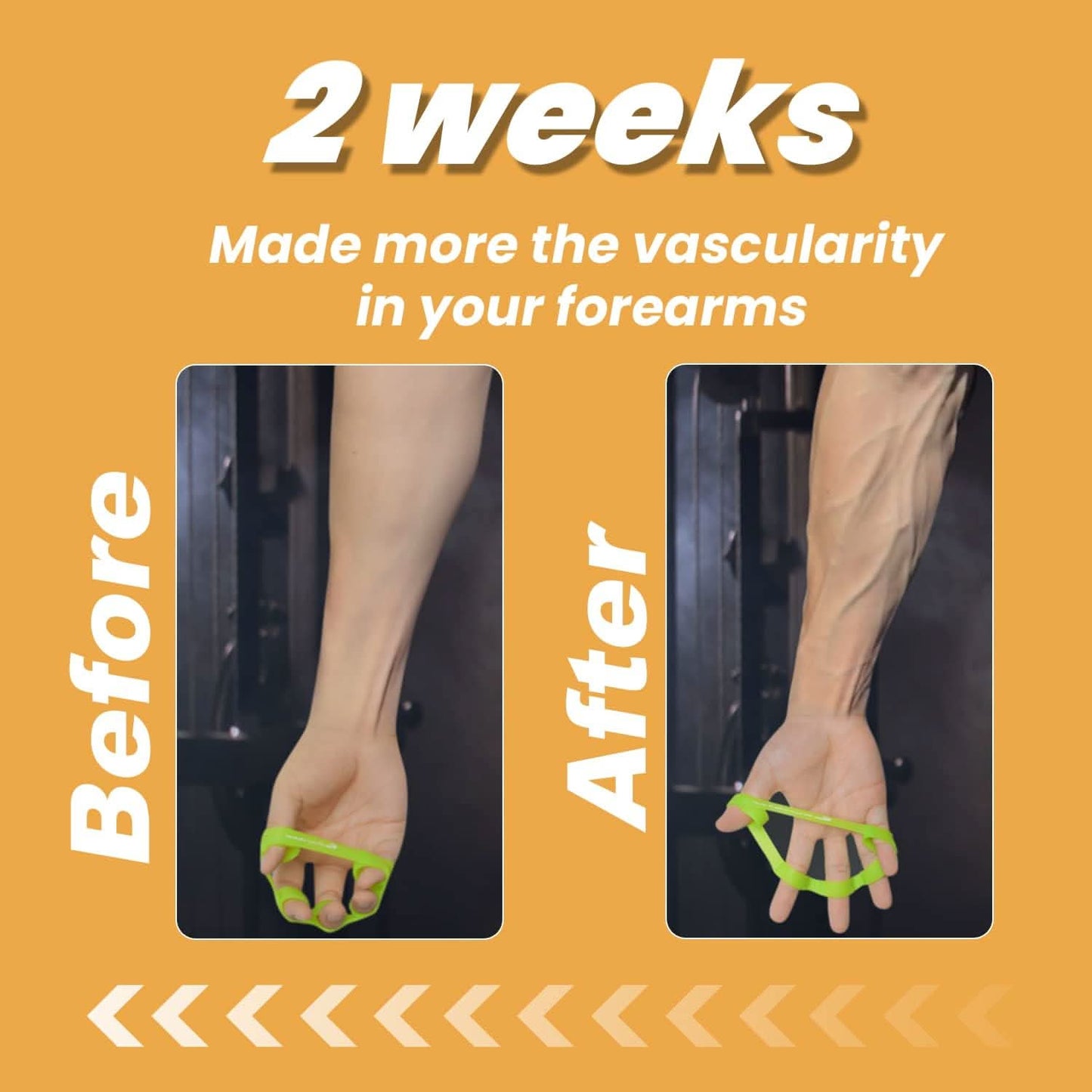 Skorter | 6-piece hand trainer set for better grip strength & pain relief