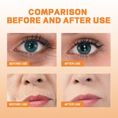 Skorter | 10 pieces collagen film mask