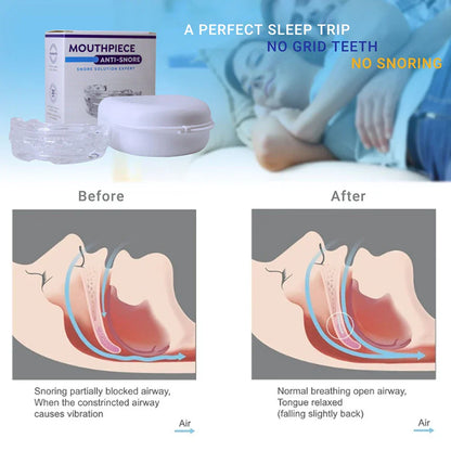 Skorter | Anti-Snore Mouthpiece