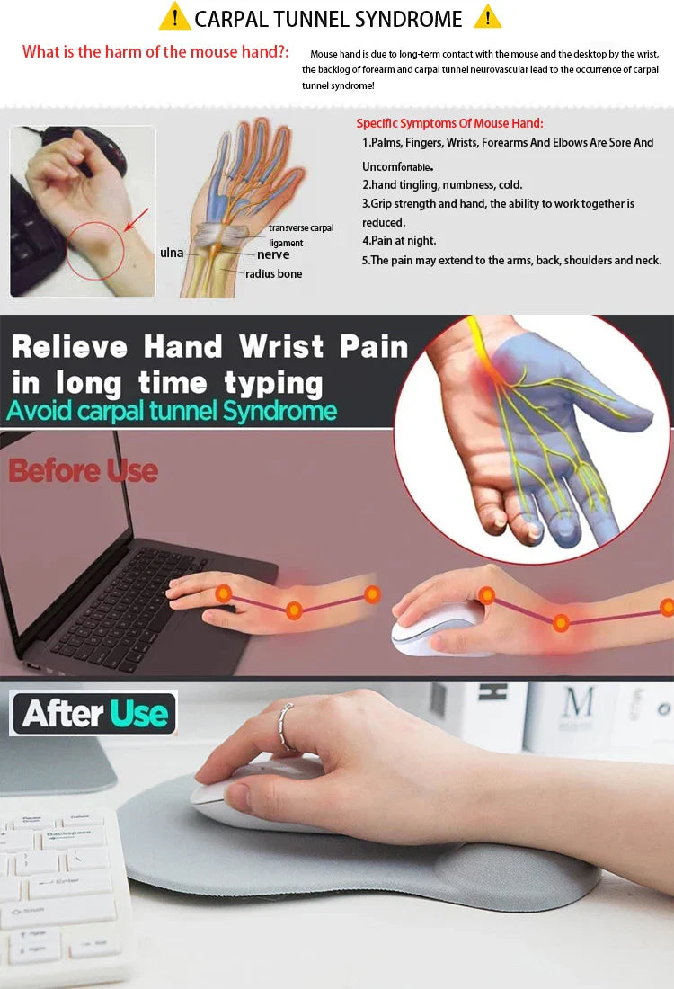 Skorter | Cute Silica Gel Ergonomic Wrist Rest Mouse Pad - ly Movable for PC & Laptop