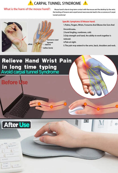 Skorter | Cute Silica Gel Ergonomic Wrist Rest Mouse Pad - ly Movable for PC & Laptop