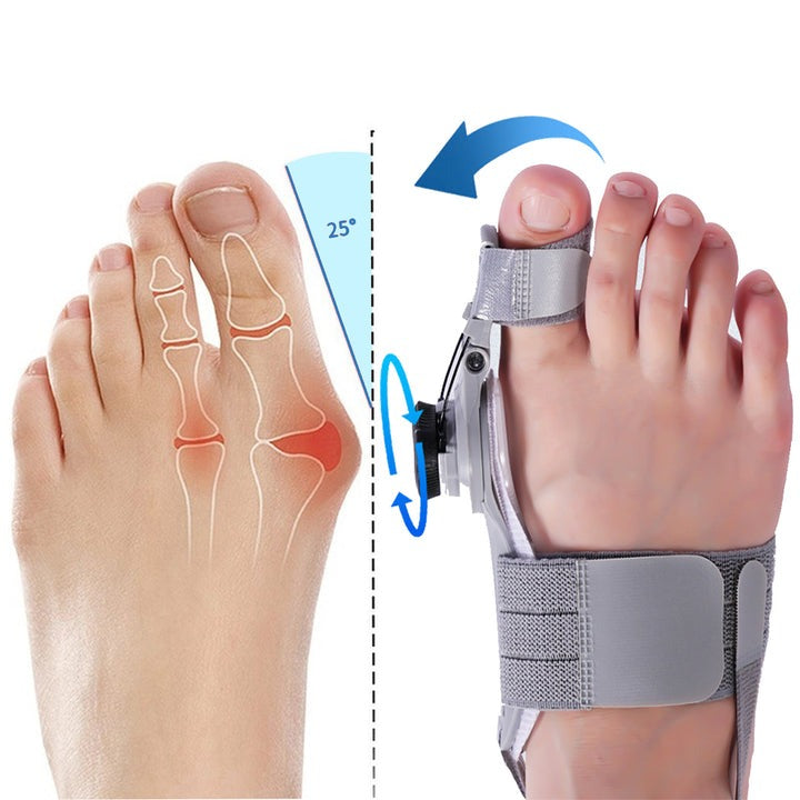 Skorter | Bunion Corrector Splint for Pain Relief and Alignment - Adjustable Foot Support for Hallux Valgus Treatment
