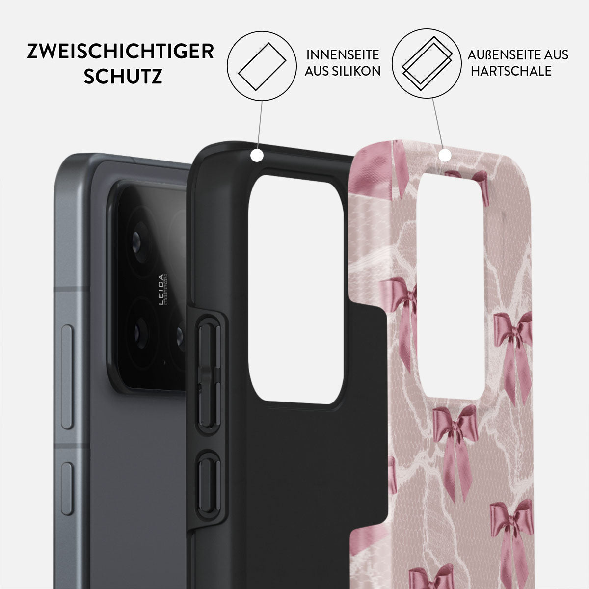 Skorter | Ballerina - Xiaomi 15 Case