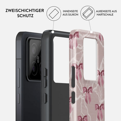 Skorter | Ballerina - Xiaomi 14 Case