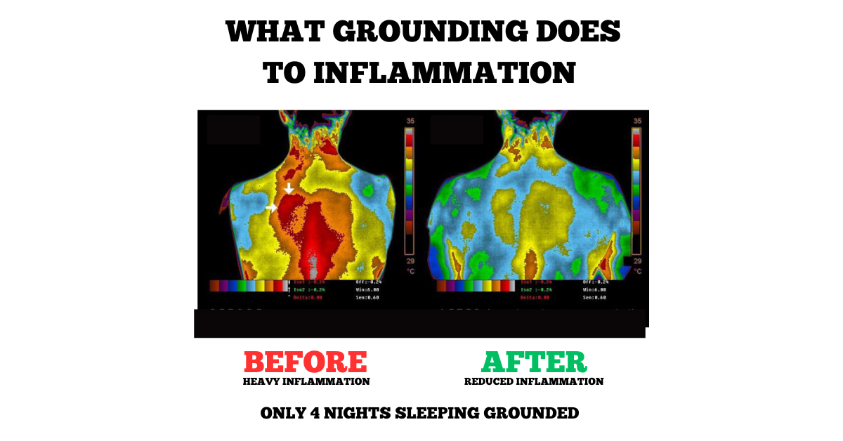 Skorter | Earthing Grounding Bed Sleep Mat - Earthing Under Sheet Pad for Enhanced Sleep Quality Grounding Well Therapy