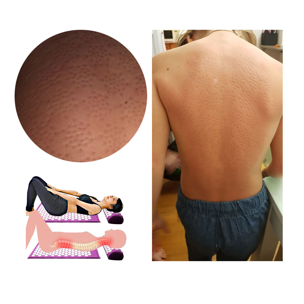 Skorter | Acupressure Yoga Mat & Cushion Set - RelaxMat