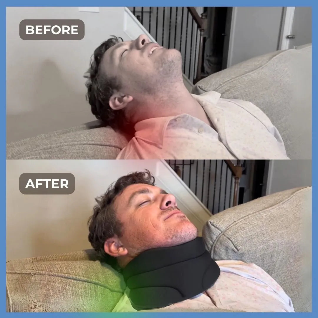 Skorter | Adjustable Neck Brace – SleepAlign