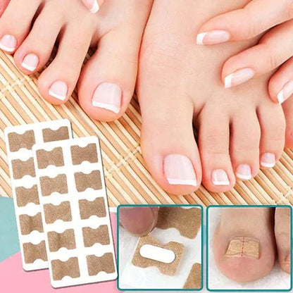 Skorter | ALIGNSTRIP – Painless Nail Correction Strips for Ingrown & Deformed Nails