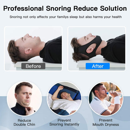 Skorter | Anti-Snore Chin Strap – DreamQuiet
