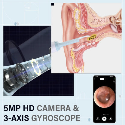 Skorter | AURIVIEW – Smart Ear Cleaner with HD Camera