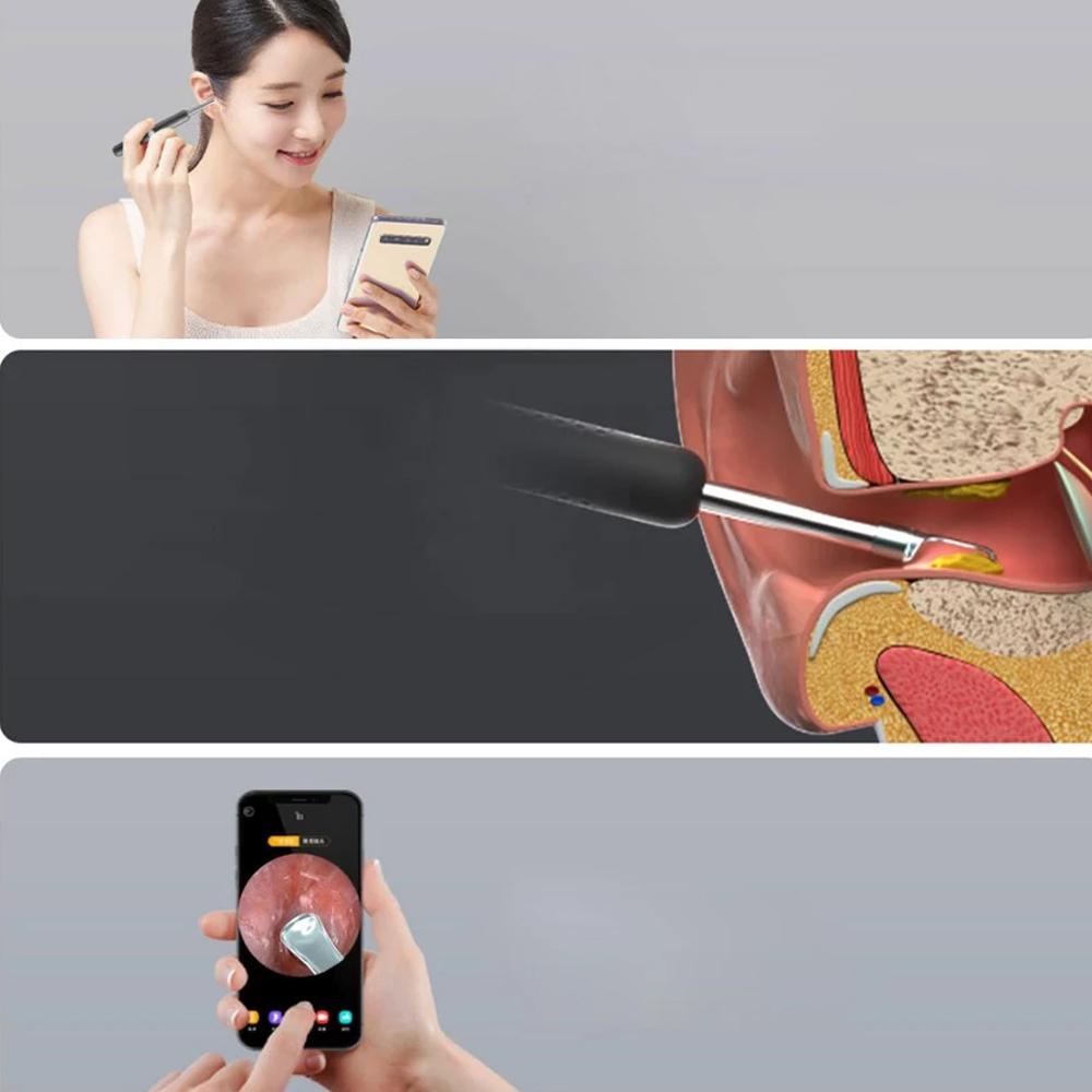 Skorter | Bebird R1 Wireless Intelligent Visual Otoscope Ear Cleaner