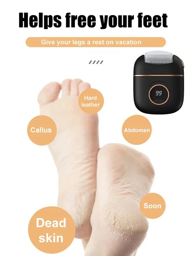 Skorter | 2025 New digital electric foot polishing machine