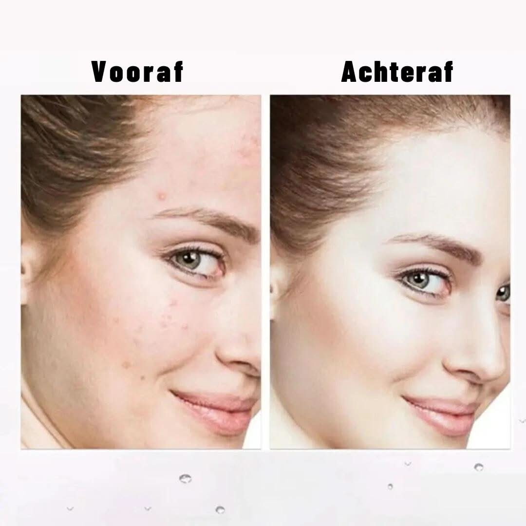 Skorter | Concealer With Brush | Double-Sided