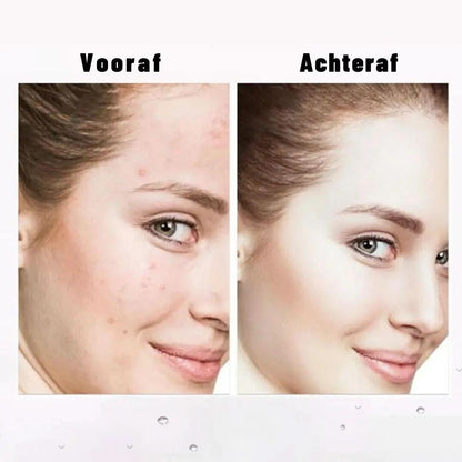 Skorter | Concealer With Brush | Double-Sided