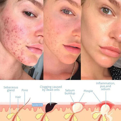 Skorter | Elysium Glow™ | Professional High-Frequency Facial Wand | Anti-Aging Skin Rejuvenation Device for Home Use & Spa Treatments