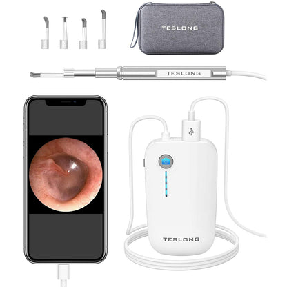 Skorter | Digital Otoscope Camera with Light