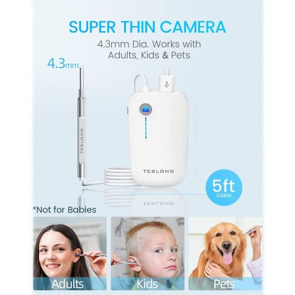 Skorter | Digital Otoscope Camera with Light