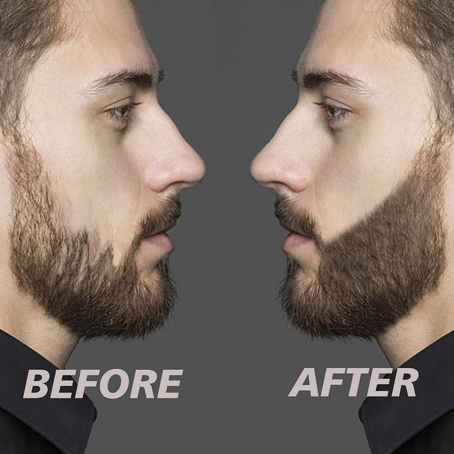 Skorter | Beard Filler Set - Tighter and Fuller Beard For All Men!