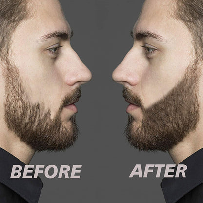 Skorter | Beard Filler Set - Tighter and Fuller Beard For All Men!