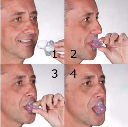 Skorter | Apnea Tongue Stabilizing Device