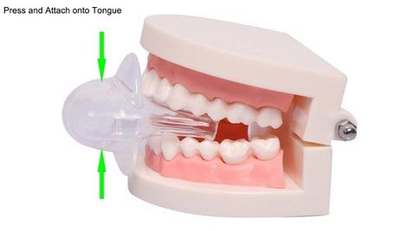 Skorter | Apnea Tongue Stabilizing Device