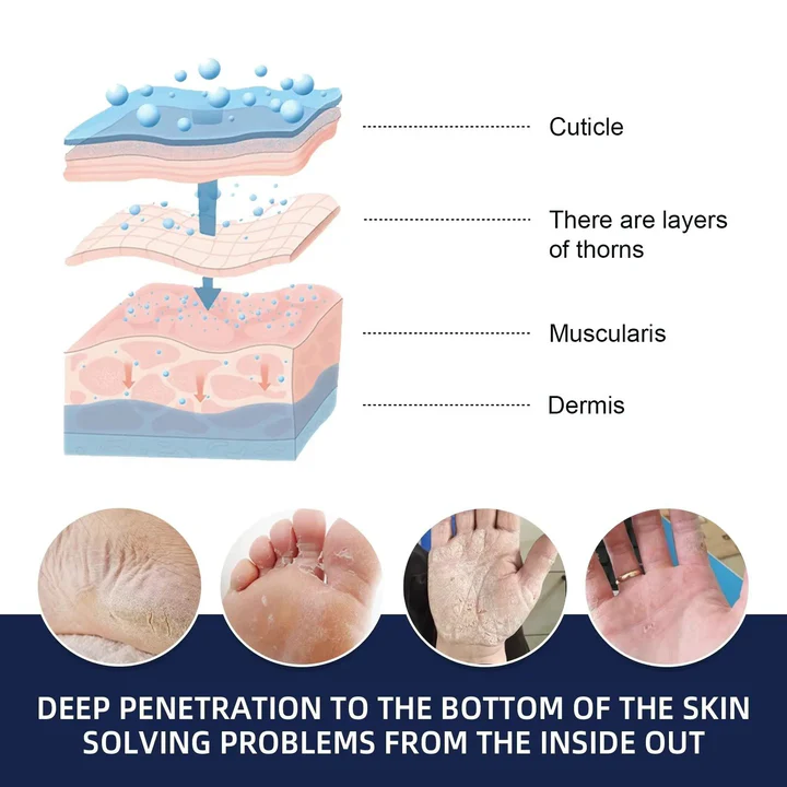 Skorter | Cracked Foot Heel Treatment Pack of 3