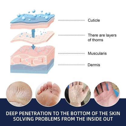 Skorter | Cracked Foot Heel Treatment Pack of 3