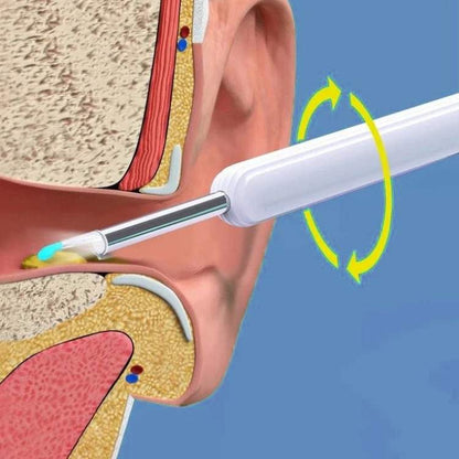 Skorter | EarScope Pro Ear Wax Removal Kit | High-Resolution Camera & LED Lights for Safe Home Use