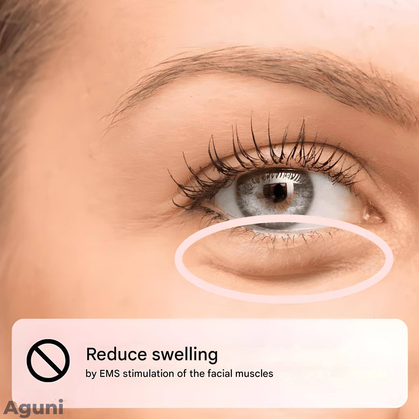 Skorter | EMS Glasses - EyeRevive