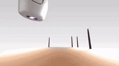 Skorter | IPL Permanent Hair Removal