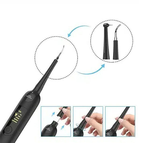 Skorter | Electric Dental Care and Descaling Kit