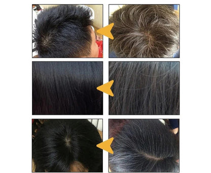 Skorter | Anti Gray Hair Shampoo Treatment