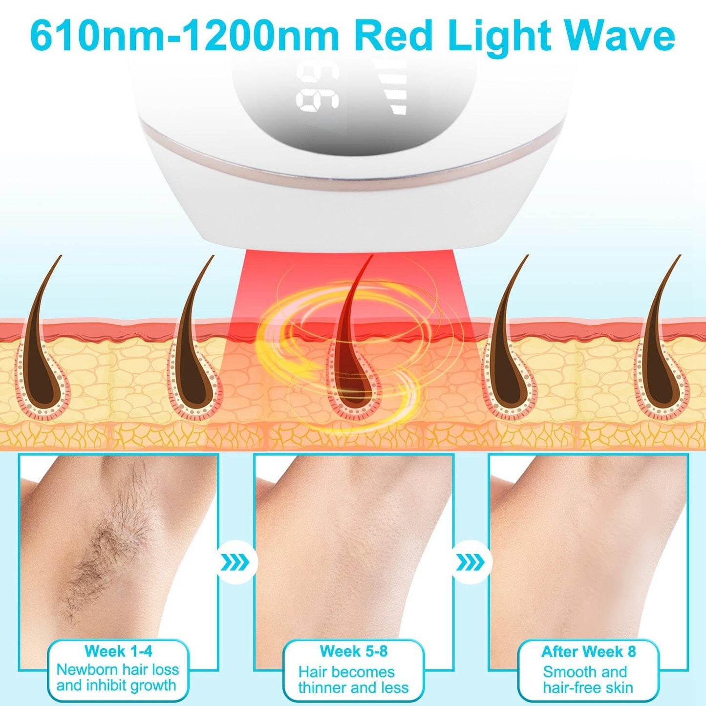 Skorter | Laser Hair Removal Ice Cooling Permanent IPL