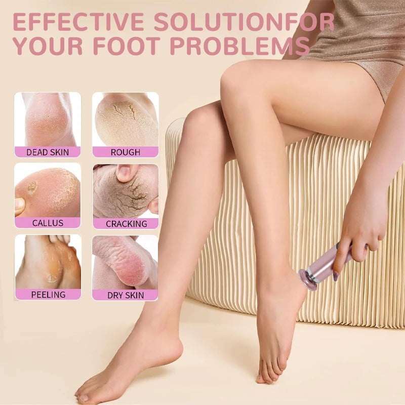 Skorter | 2-in-1 Electric Foot & Hand Care Tool | Callus Remover & Nail Polisher for At-Home Pedicures