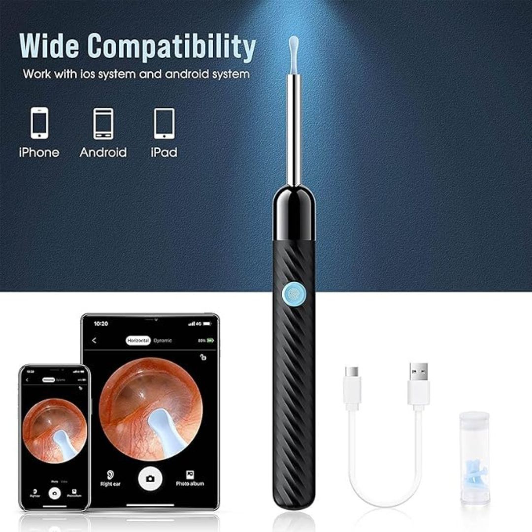 Skorter | Ear Wax Removal Tool | 1080P HD Camera, LED Lights & Adjustable Scoops for Safe Ear Hygiene at Home