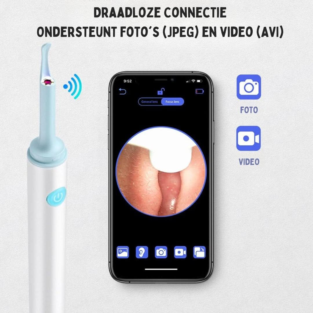 Skorter | Ear Cleaner | Easy Earwax Removal