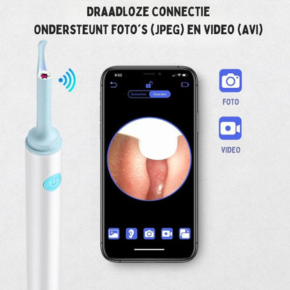 Skorter | Ear Cleaner | Easy Earwax Removal