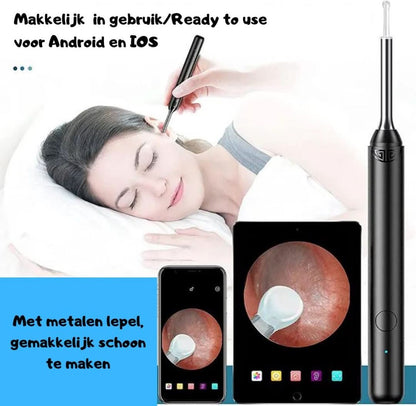 Skorter | Ear Cleaner | Easy Earwax Removal