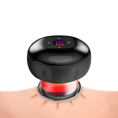 Skorter | Electric Cupping Massage Device
