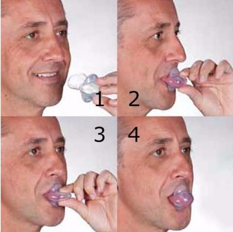 Skorter | Apnea Tongue Stabilization Device
