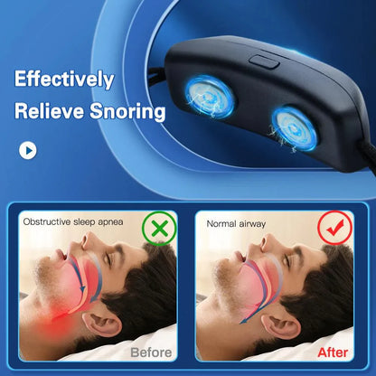 Skorter | Anti Snoring Device EMS Pulse Stop Snore Effective Aid for Snoring Prevention