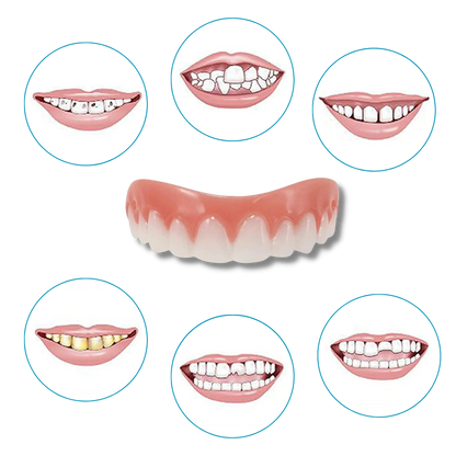 Snap-On Veneer Teeth