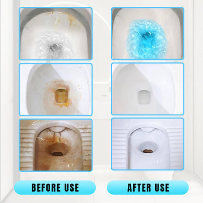 Skorter | Effective concentrated descaling stick for toilet cleaning
