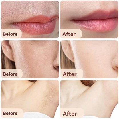 Skorter | 2 in 1 facial hair remover and brow trimmer (50% off)