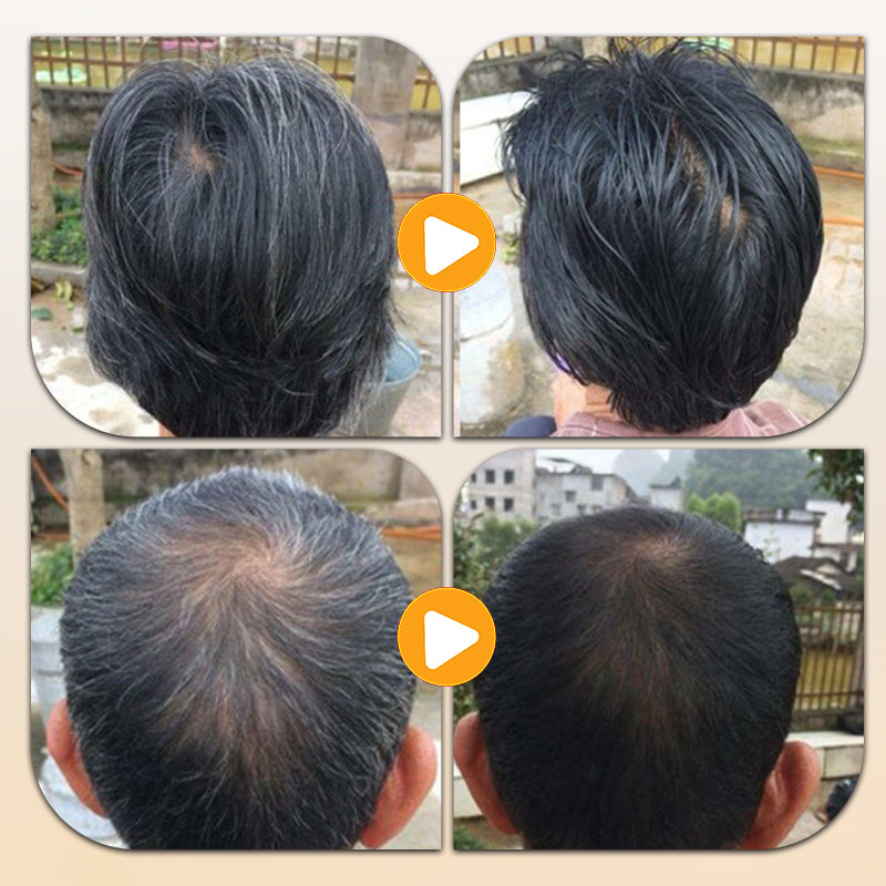 Skorter | Mild & Plant-Based Long-Lasting Hair Dye